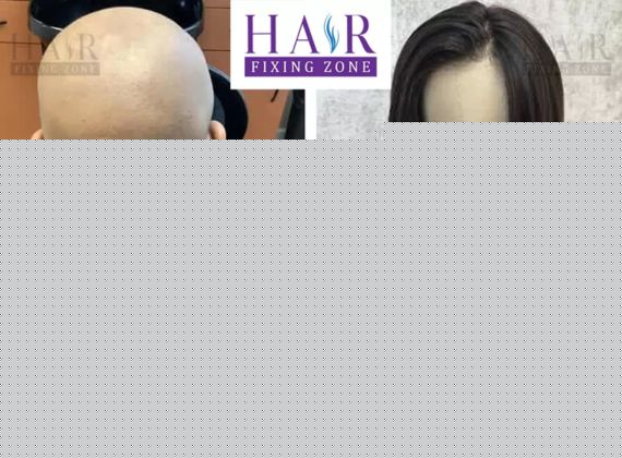 Clip in Hair system