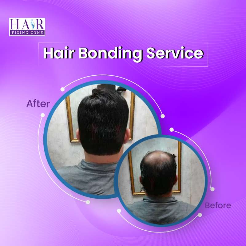 Hair Bonding