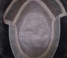 Hair Patches In HSR Layout