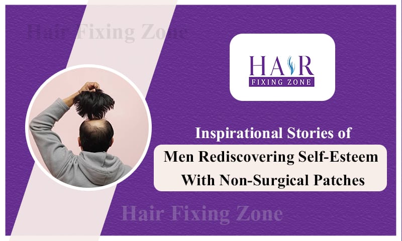 Inspirational Stories of Men Rediscovering Self-Esteem with Non-Surgical Patches