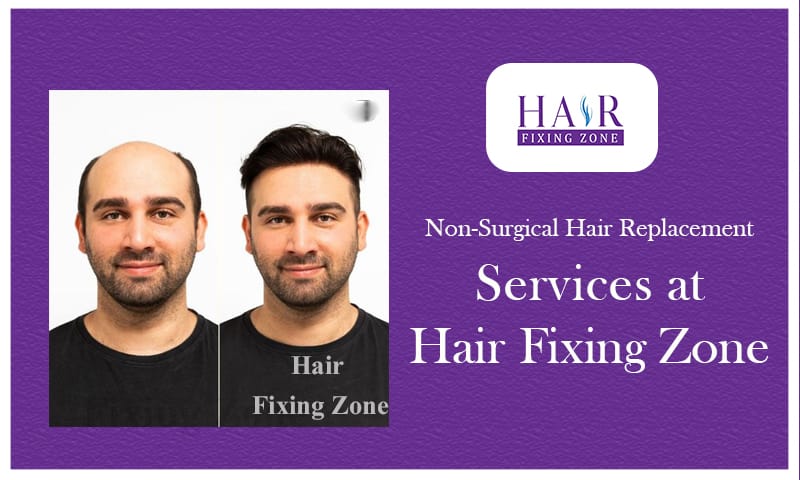 Non-Surgical Hair Replacement Services at Hair Fixing Zone